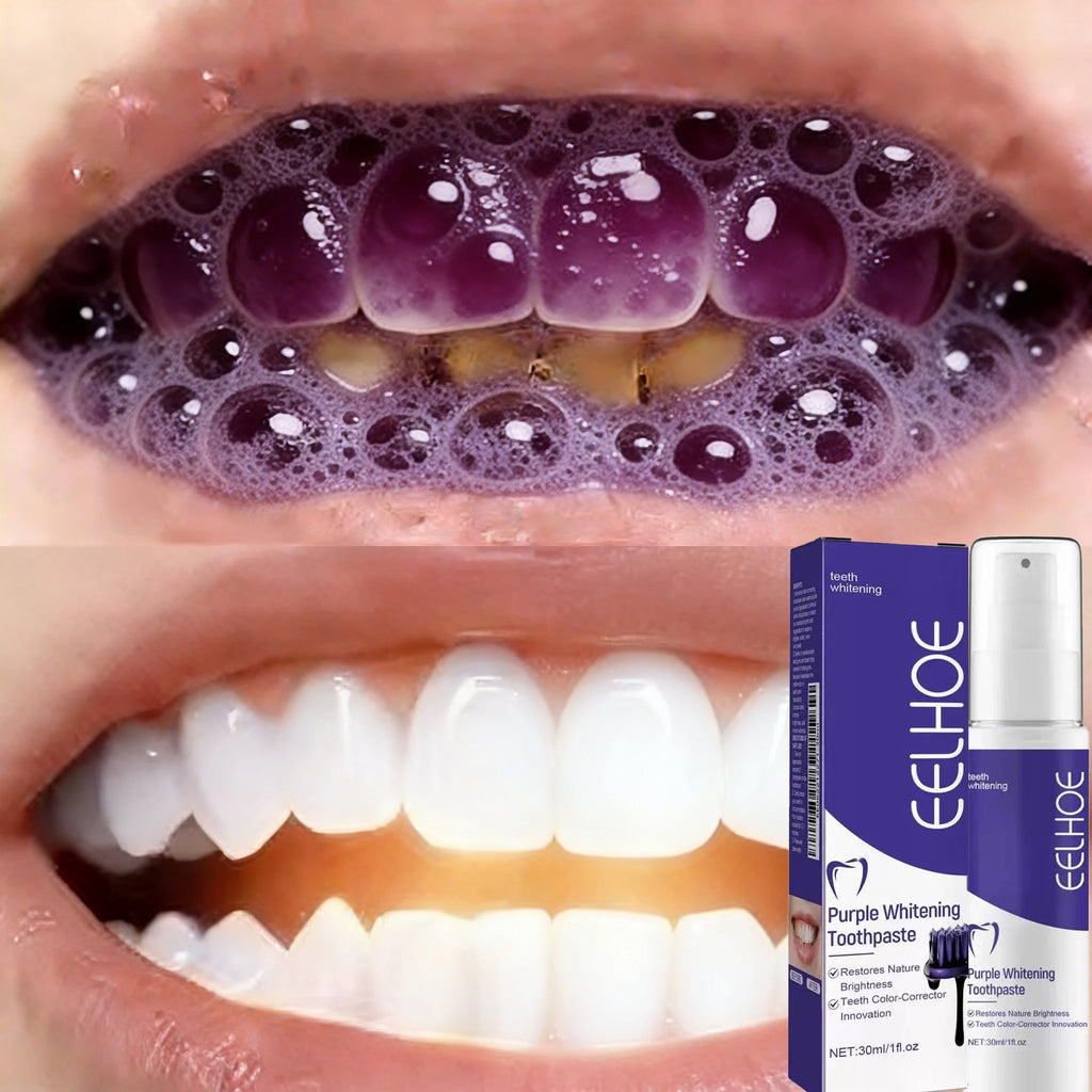 2026 Bestselling Whitening Toothpaste: Say Goodbye to Yellow Teeth, Oral Hygiene Cleaning, and Teeth Care Tool