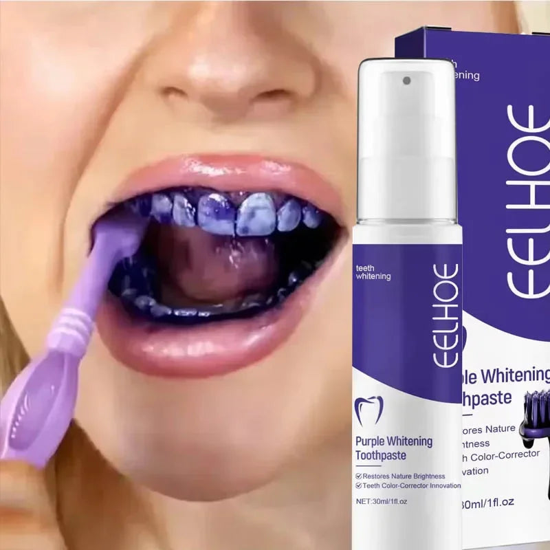 2026 Bestselling Whitening Toothpaste: Say Goodbye to Yellow Teeth, Oral Hygiene Cleaning, and Teeth Care Tool