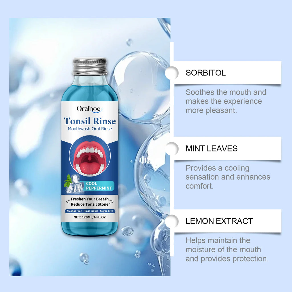 120ml ORALHOE Mouthwash Oral Rinse Remove Food Residues Bad Breath Reduce Tonsil Stone Eliminate Odor Breath Oral Care